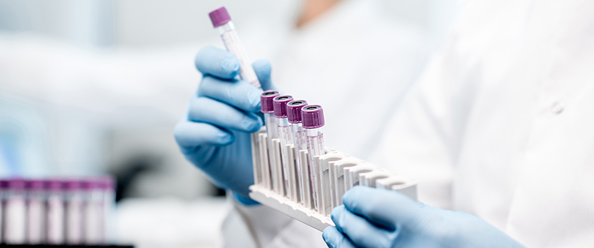 A person wearing blue gloves and a lab coat handles several blood sample vials with purple caps, placing them in a white test tube rack, as if preparing evidence for chicago lawyers in a laboratory setting.