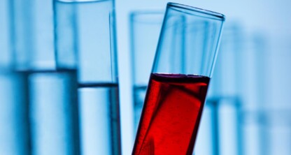 A group of clear glass test tubes, one filled with a red liquid, is set against a blue background—an image often seen in law offices or used by lawyers in Chicago specializing in intellectual property law.